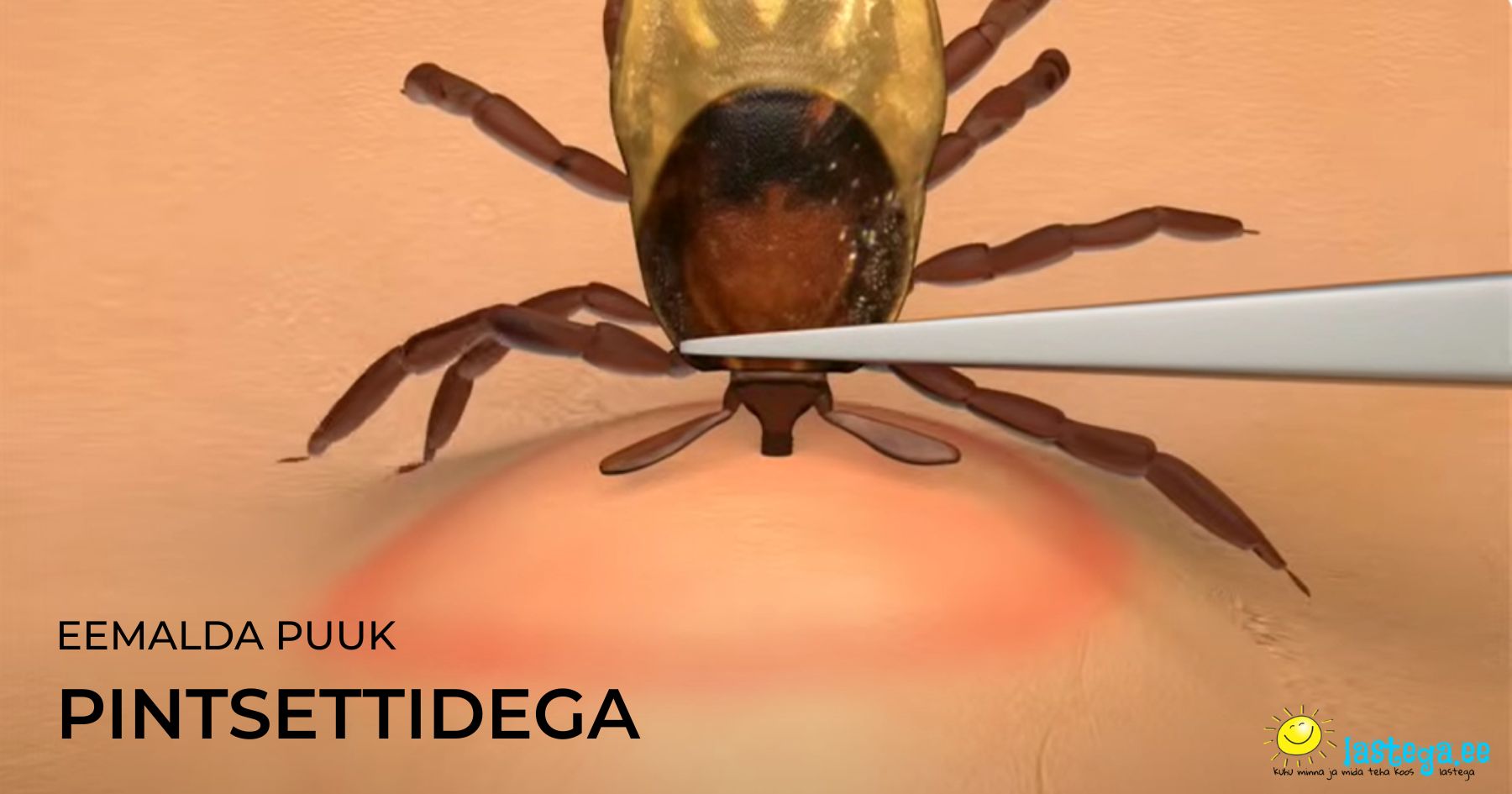  Puugi eemaldamise ABC: Vaata videot ja saa meistriks!